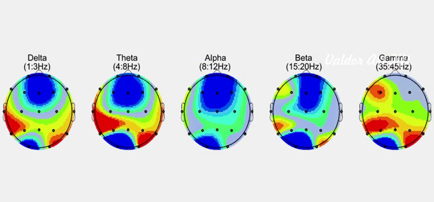 N%C3%A9vtelen%20terv%20%282%29 2 - ValdorArt